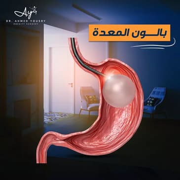 Slider image (4) Dr. Ahmed Yousry Clinic